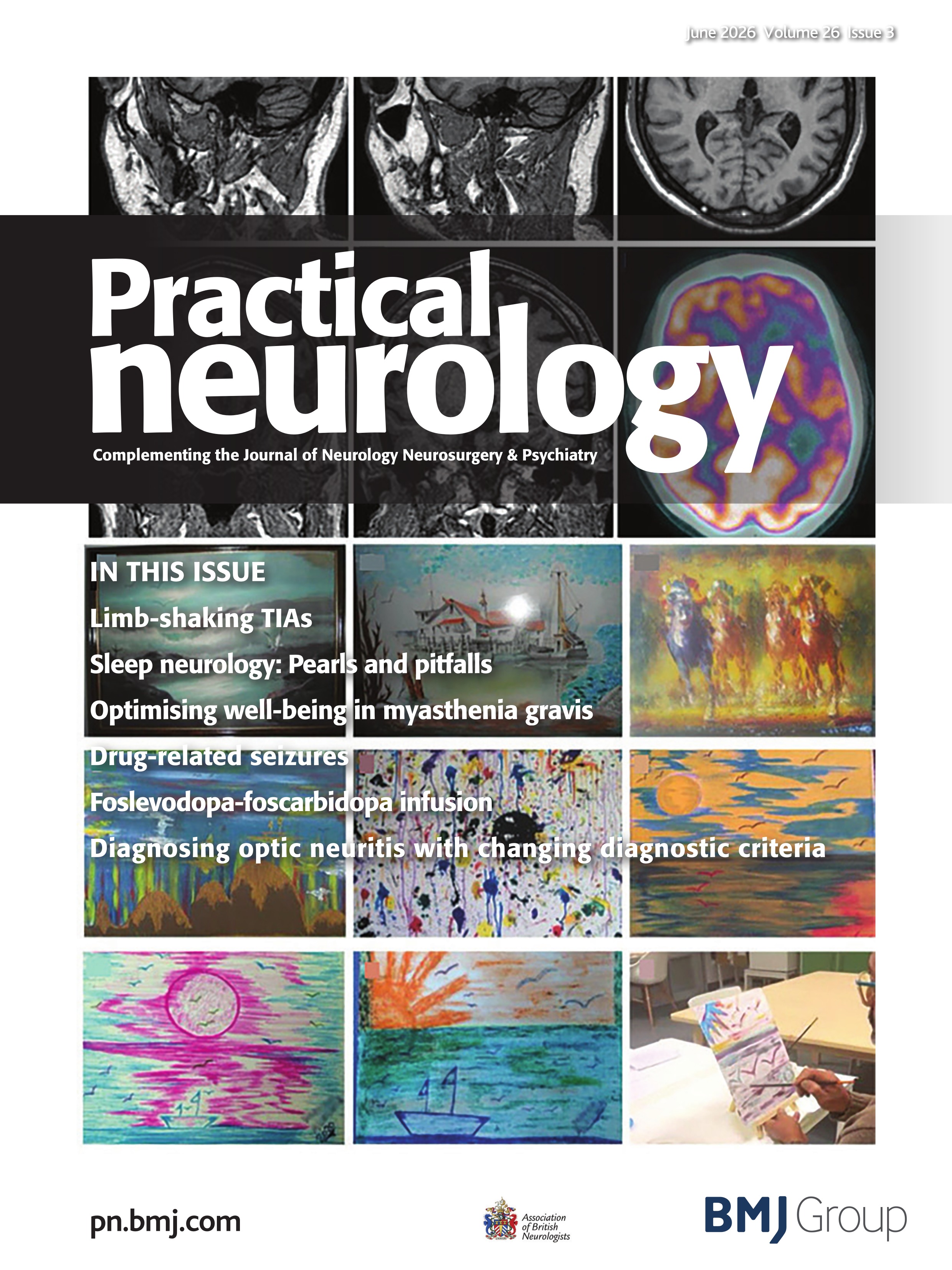Cerebral venous sinus thrombosis complicating IgG4-related hypertrophic pachymeningitis