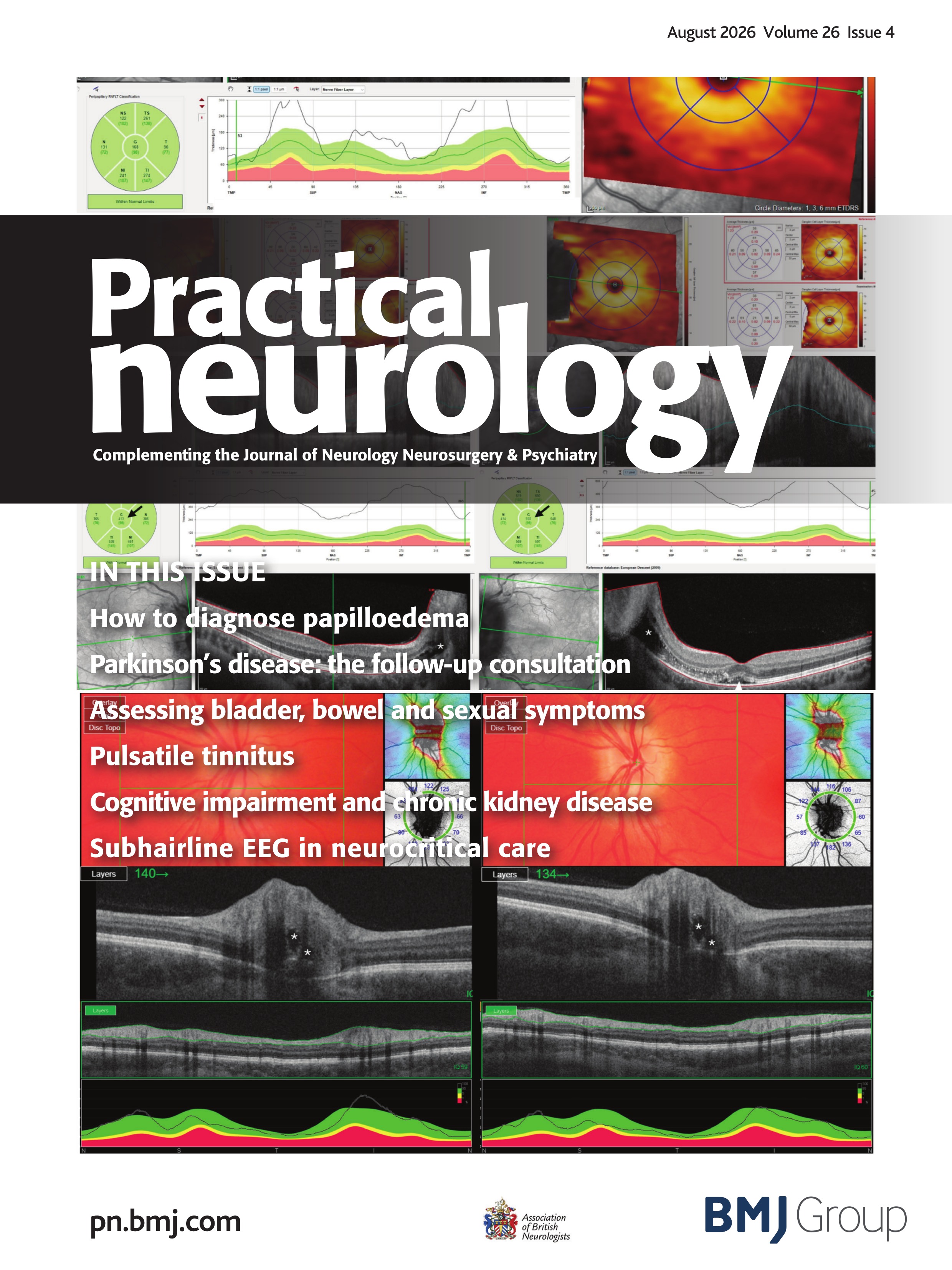 Pontocerebellar inflammation and pancytopenia